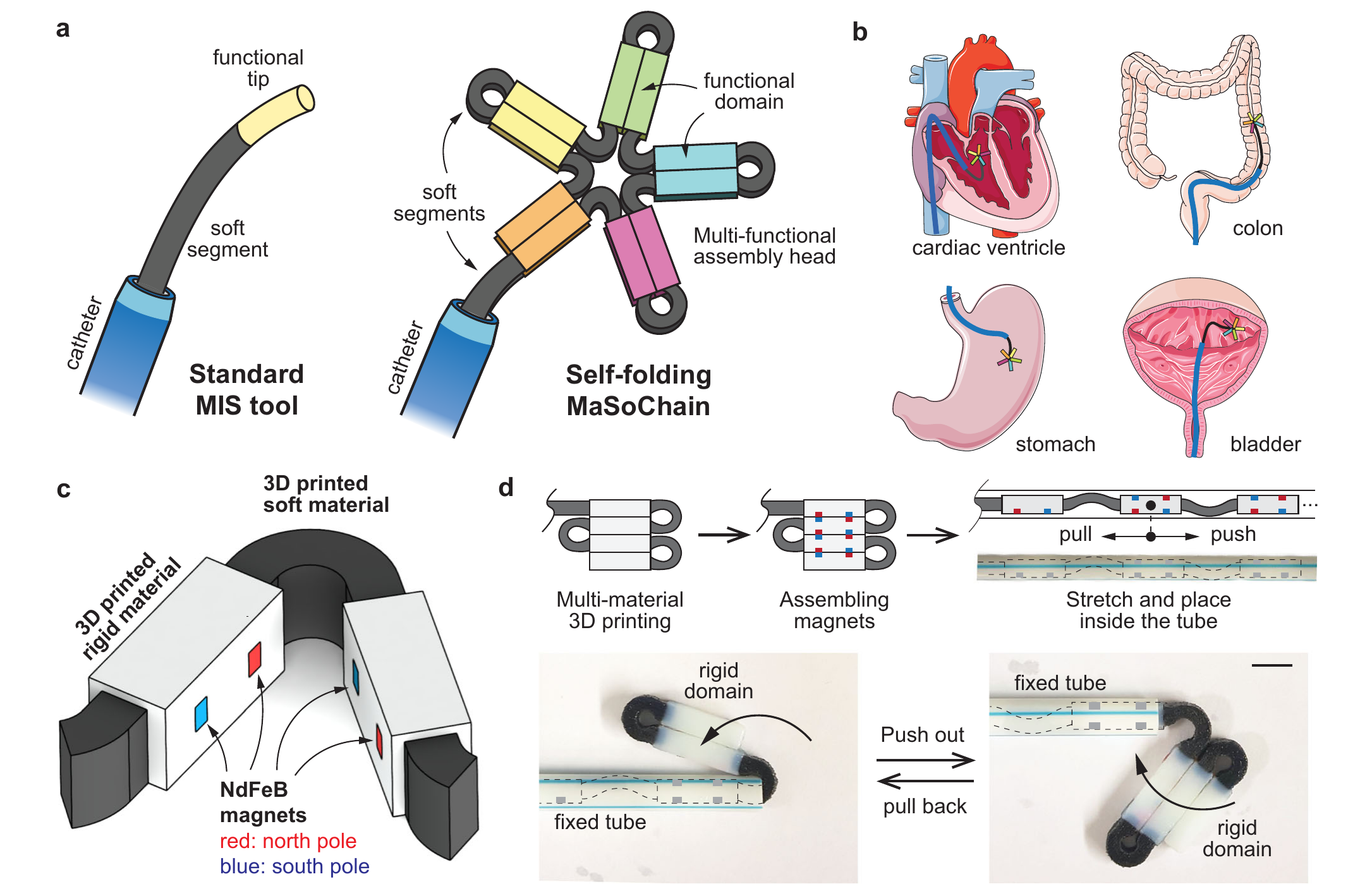 A programmed rigid-soft chain folds after catheter delivery and can be retrieved again.
